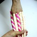การรักษานิ้วล็อค (งูกินนิ้ว)